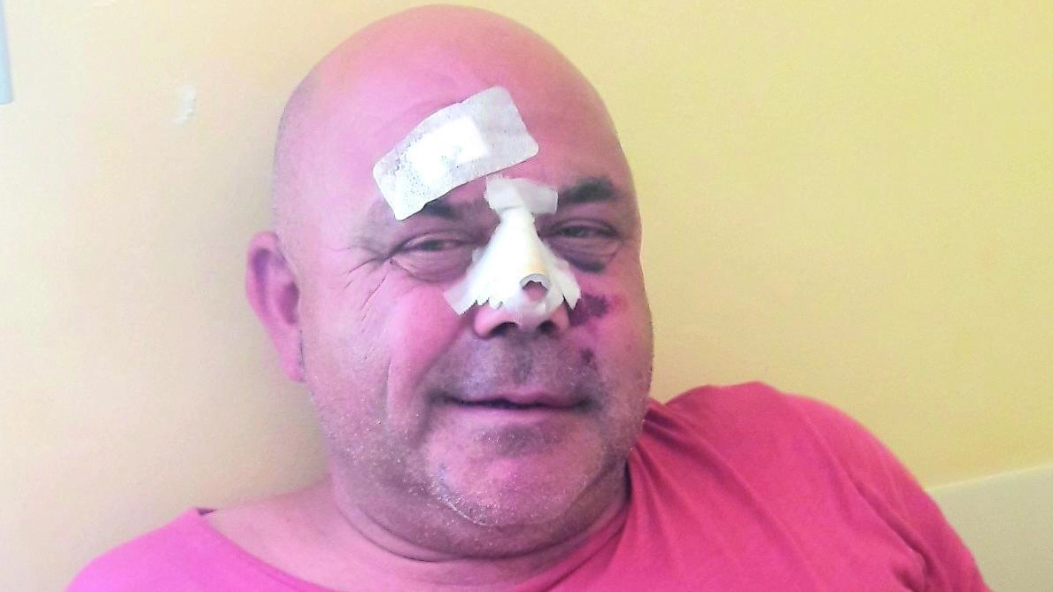 Luciano Olivanti, 54enne gestore del ristorante ‘La Fenice’, ha subito un assalto brutale in casa