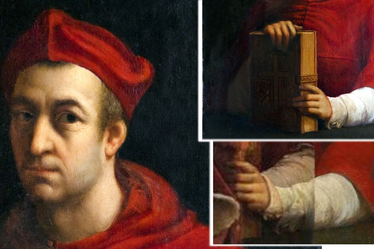 Luigi de' Rossi (particolare); il braccio riposizionato rispetto al quadro di Leone X