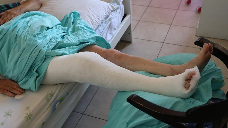 La gamba  ingessata del 72enne dopo l'investimento in monopattino (FotoSchicchi)