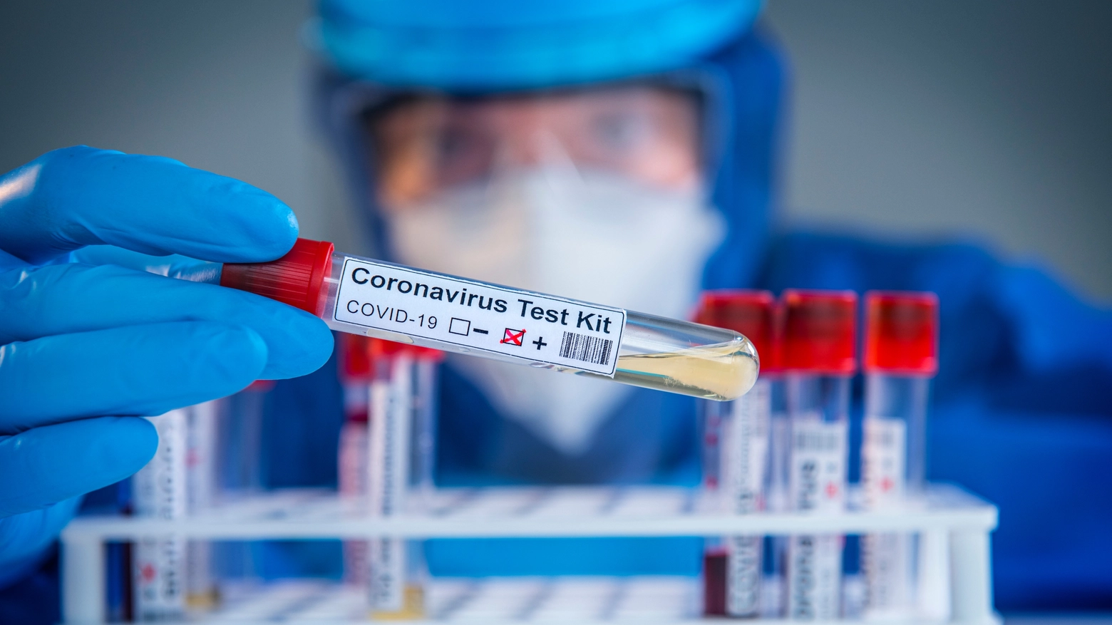 Coronavirus, in Veneto i contagi sono ancora alti. Dati del 13 ottobre