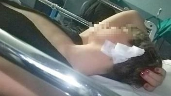 La giovane donna in ospedale subito dopo la feroce aggressione del fidanzato