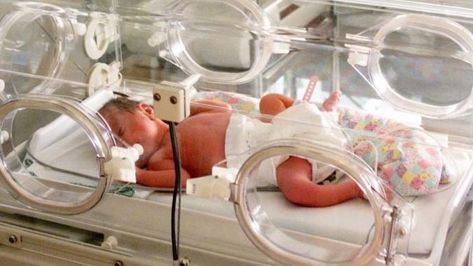 Un neonato in un'incubatrice