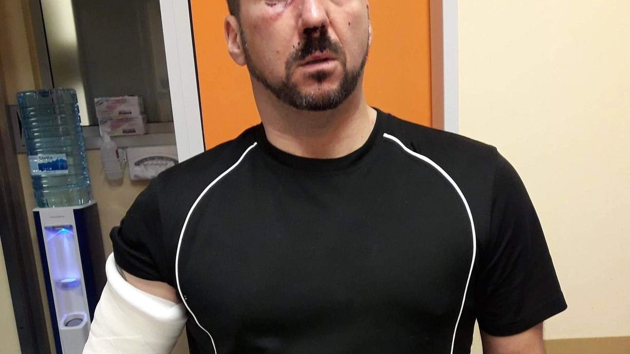 Diego Compagnucci, 46 anni, di Jesi, accusa due albanesi di averlo pestato