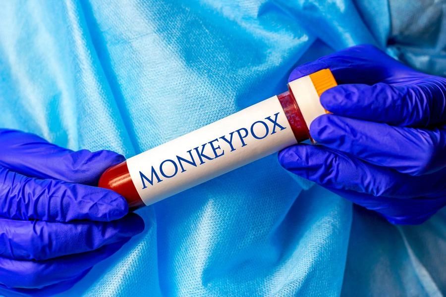 Il virus del vaiolo delle scimmie  'Monkeypox' (Adnkronos)