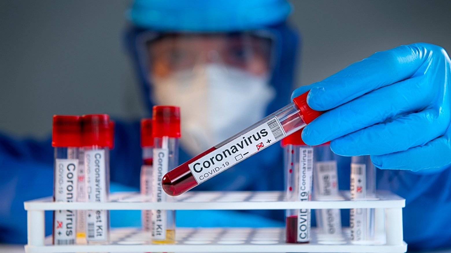 Coronavirus, a Bologna tornano a crescere i contagi il 24 giugno