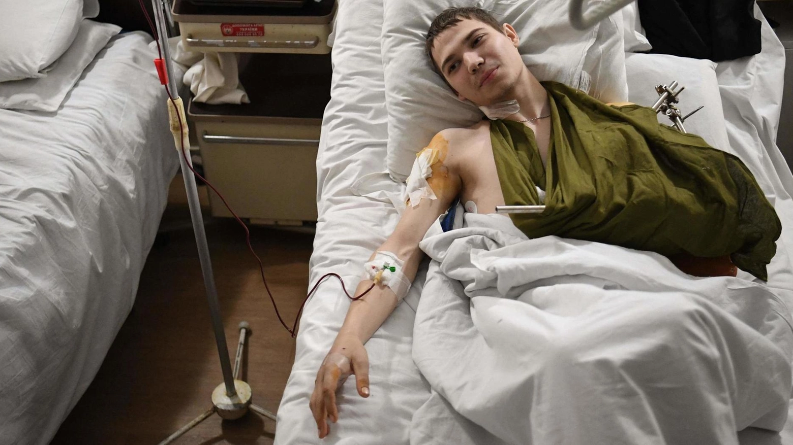 Un soldato ucraino, di appena 19 anni, ricoverato nell’ospedale di Leopoli (Ansa)