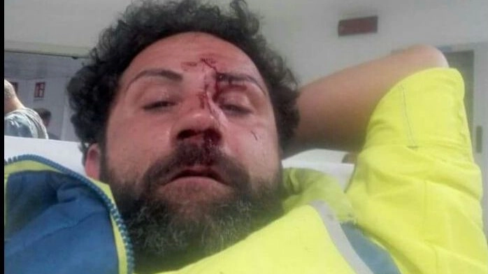 IN AMBULANZA Tomas Sanchioni, 40enne ambulante. Ha riportato la frattura del setto nasale e dovrà sottoporsi a un intervento