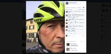 Paolo Belli: "Urtato in bici da un pirata della strada"