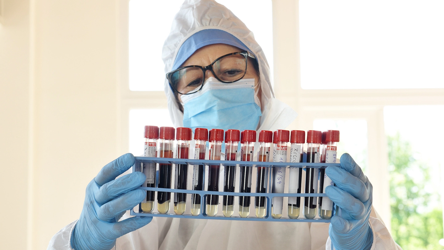 Test sierologici, esami per rilevare gli anticorpi da coronavirus (Cusa)
