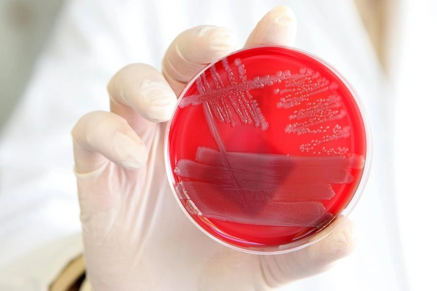 Escherichia coli, batterio resistente agli antibiotici (Ansa)