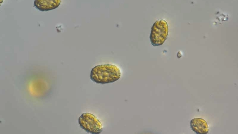 Le analisi di Arpae su alcuni campioni di acqua marrone: è un'alga innocua