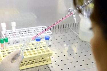 Microplastiche nelle urine, la scoperta dell’università delle Marche: i rischi per l’uomo