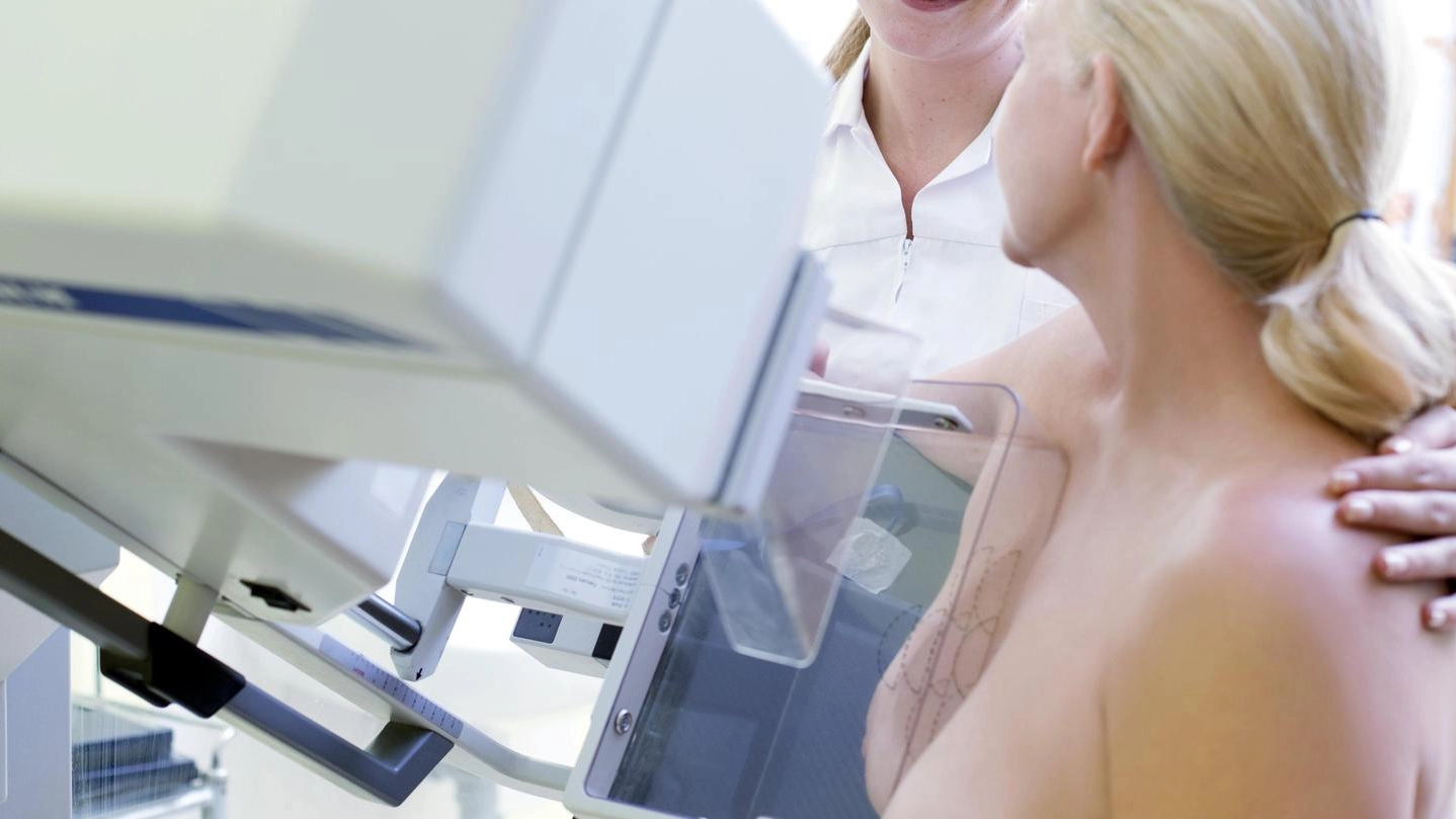 Una donna si sottopone a una mammografia (Olycom)