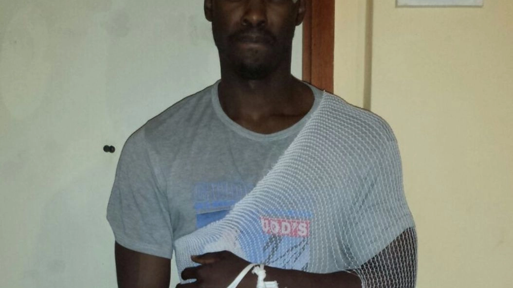 Julio Adjeitey, 23enne commesso allo Sport Service, con le ferite dopo l’incidente