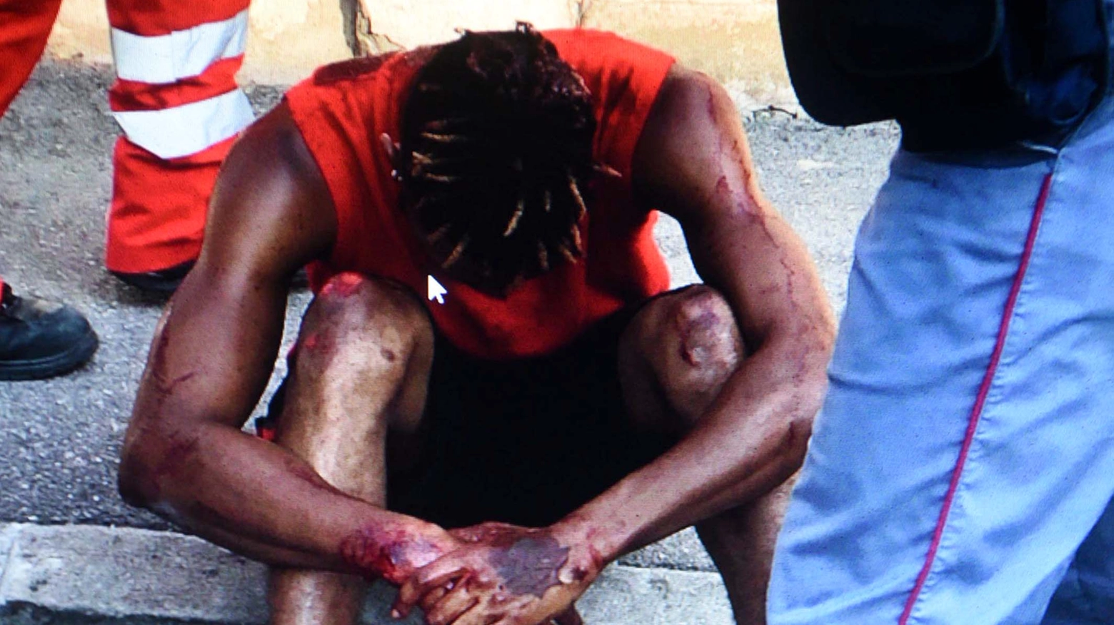 Il ragazzo ferito durante l'aggressione in via Oroboni