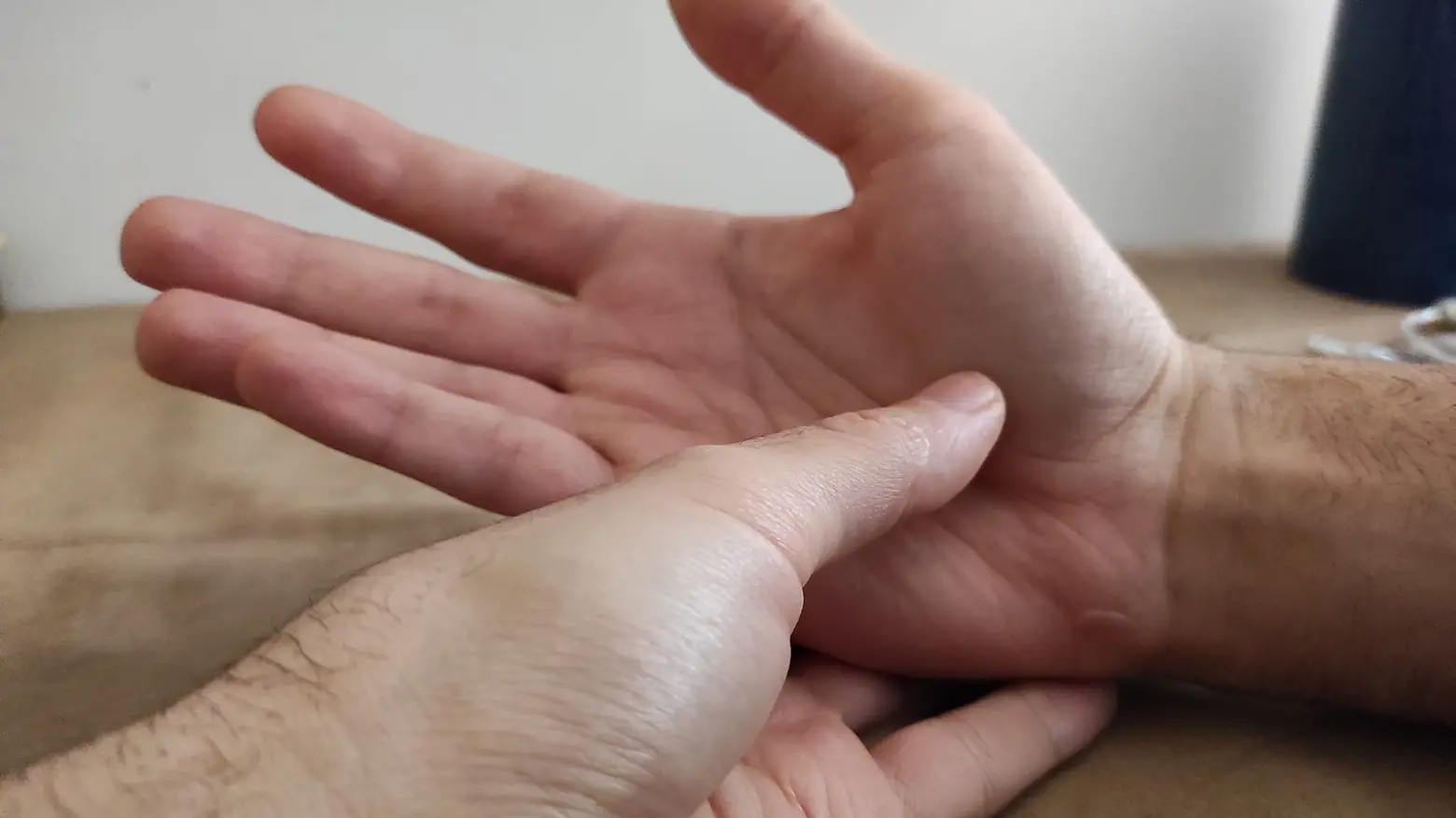 La zona della mano più soggetta ai sintomi