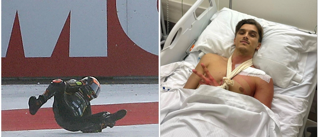 Il pilota, fratello di Valentino Rossi, posta una foto dall'ospedale, con la clavicola sinistra fratturata, a tre giorni dall’incidente alla Sprint Race in India