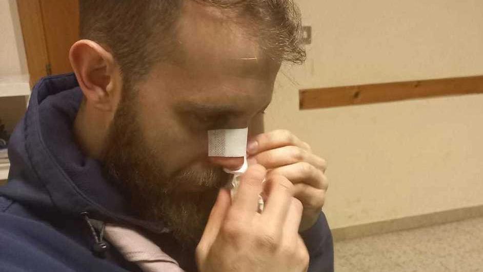 Andrea Turchi, 29 anni, ingegnere pesarese, mentre si asciuga il sangue dal naso