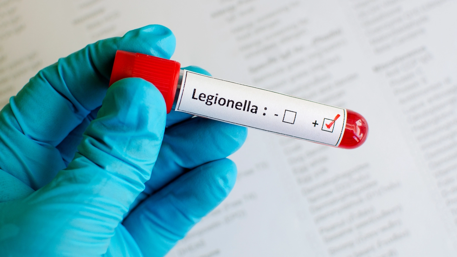 Legionella: un uomo di Ancona è risultato positivo al batterio a Porto Recanati