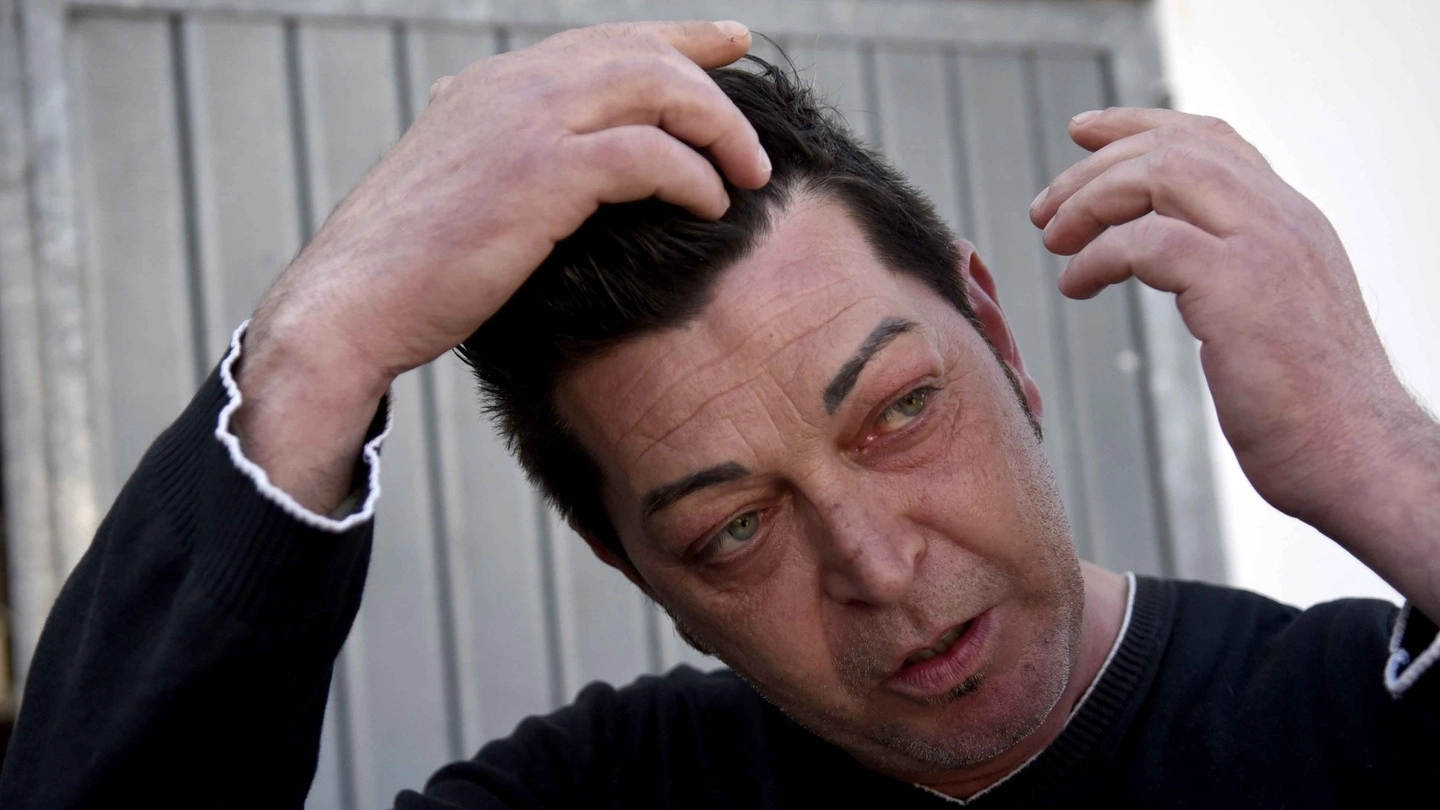 Alessandro Colombani, 49 anni, mostra una delle ferite subite durante l’aggressione