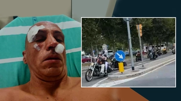 Aggressione in discoteca a Bologna, tre persone ferite dai motociclisti tedeschi