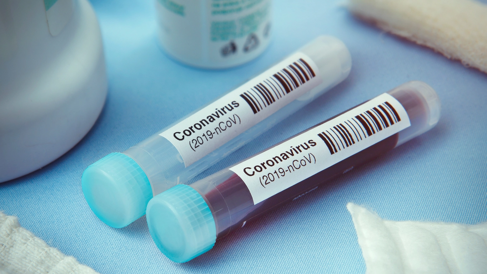 Coronavirus, due morti a Medicina (foto d'archivio)