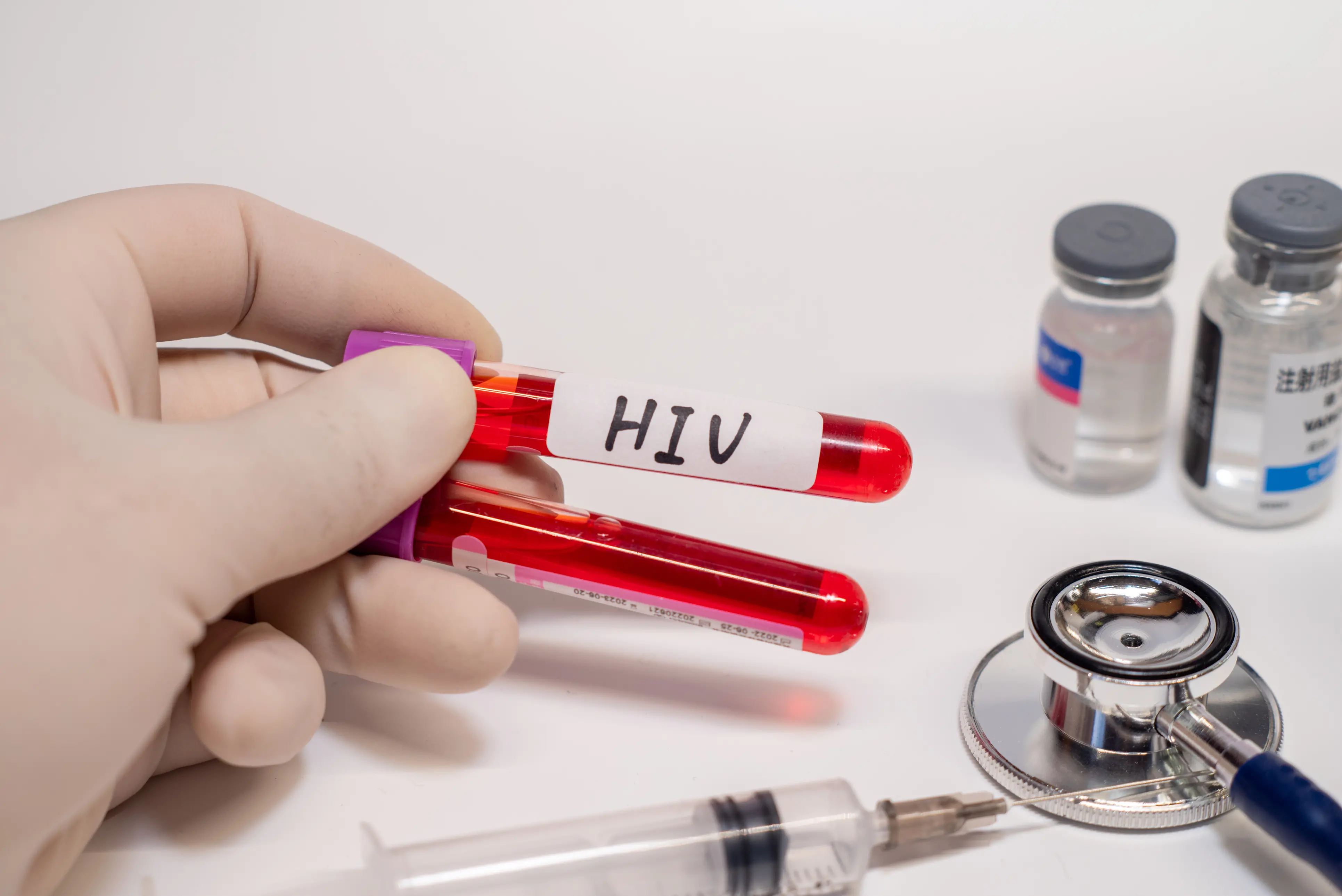 test hiv gratis e anonimi in emilia romagna dove farli da Ilrestodelcarlino.it test hiv gratis e anonimi in emilia romagna dove farli