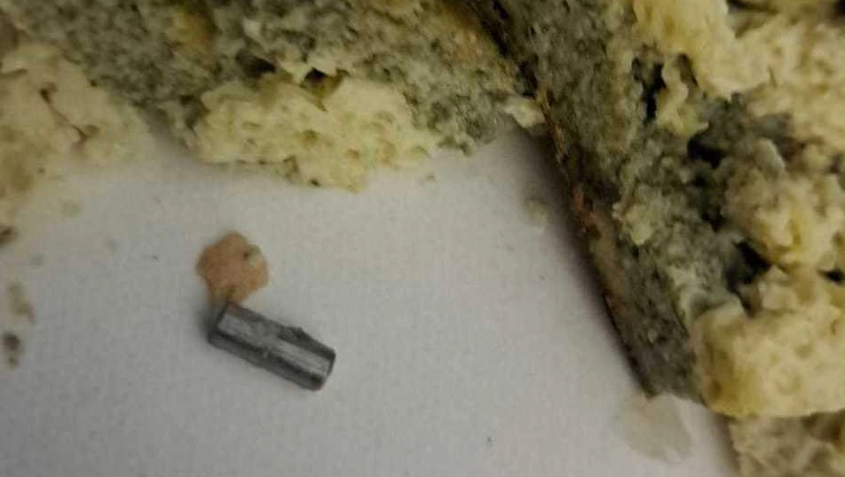 Il pezzo di ferro trovato dalla paziente oncologica all'ospedale Torrette nella cena: dente scheggiato e lingua tagliata