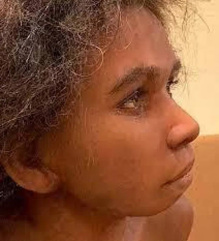 Il volto ricostruito da una rielaborazione al computer del celebre Bambino di Isernia i cui ritrovamenti lo fanno risalire a 600mila anni fa