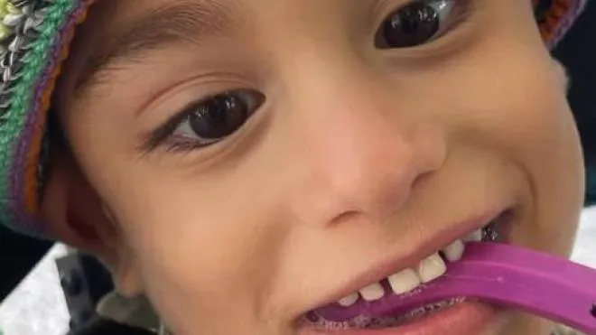 Martin Di Roberto, 5 anni, affetto da tetraparesi spastica